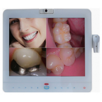 Magenta®15Inch歯科用口腔内カメラMD1500有線(VGA+VIDEO+HDMI+USB)